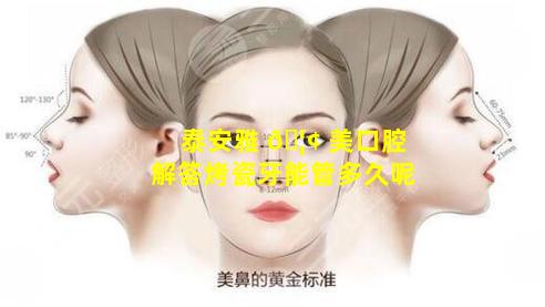 泰安雅 🦢 美口腔解答烤瓷牙能管多久呢